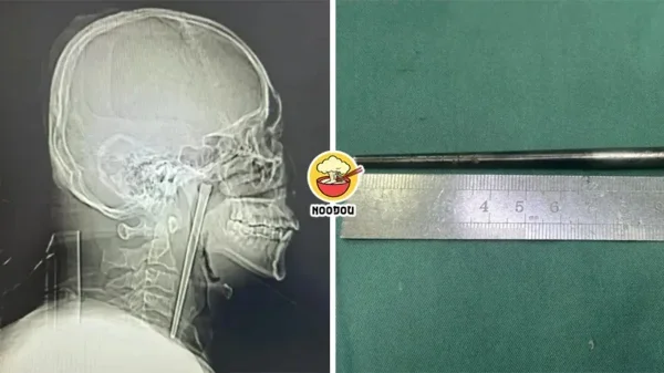 Chopstick Telan 8 Years Ft Img