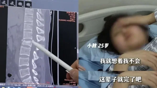 25岁走楼梯按手机踩空摔倒下肢瘫痪 1