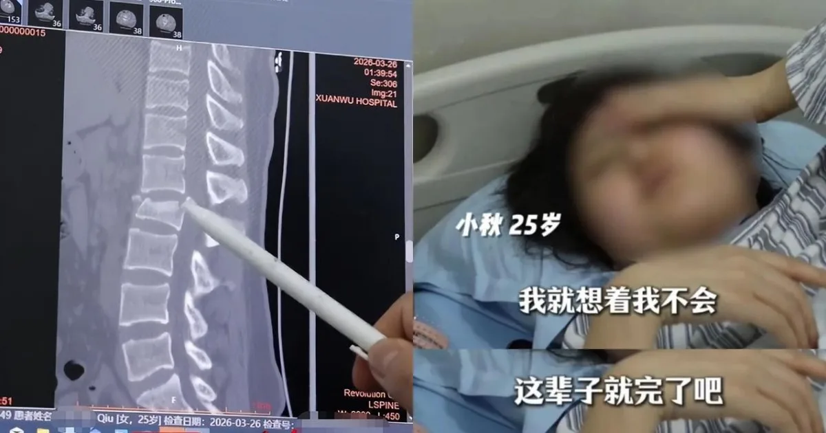 25岁走楼梯按手机踩空摔倒下肢瘫痪 1