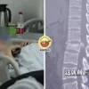 See Phone Stairs Fall Ft Img