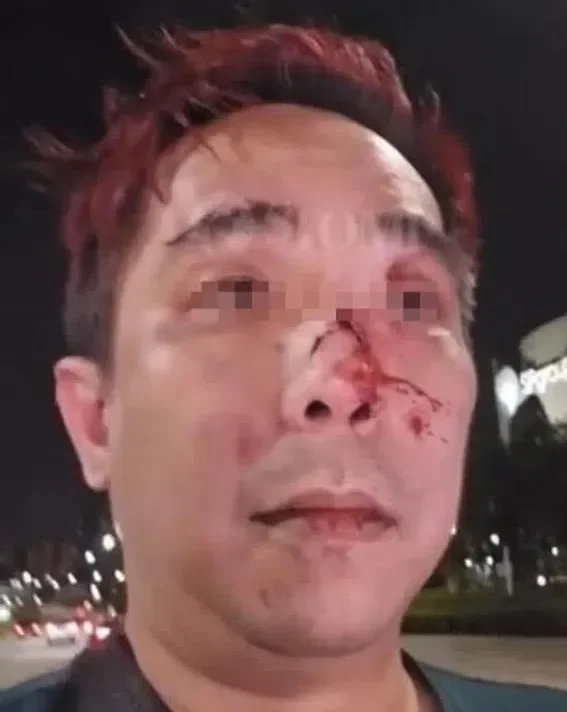 电召车司机被2乘客殴打