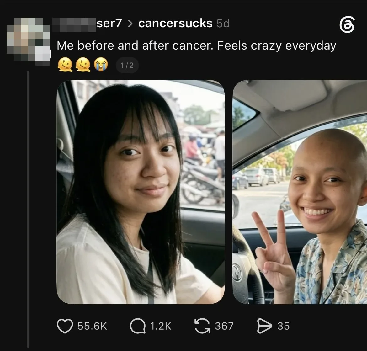 Before After 1
